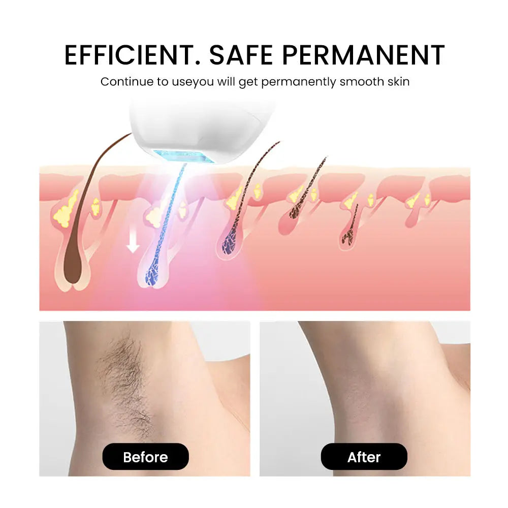 IPL hair removal Sapphire ice pointpainless Super Fast speed 0.25s/flash Ice Cooling Ipl Laser Hair Removal Epilator RISE DEFENSE SYSTEMS.AI PRODUCTS
